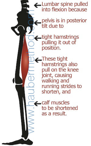 tight hamstrings cause back pain